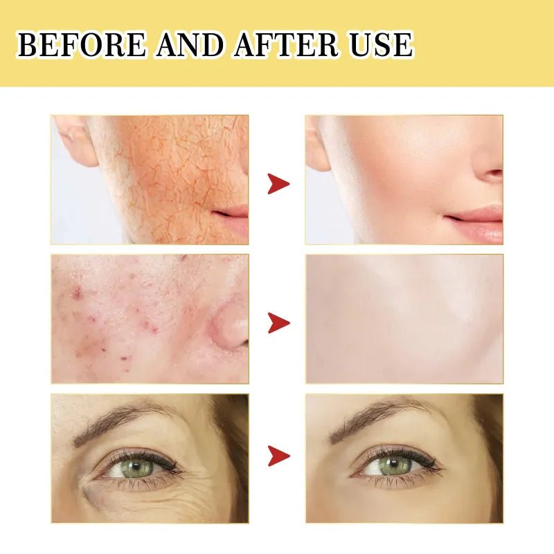 Snail Collagen Power Repairing Liquid - trend.co